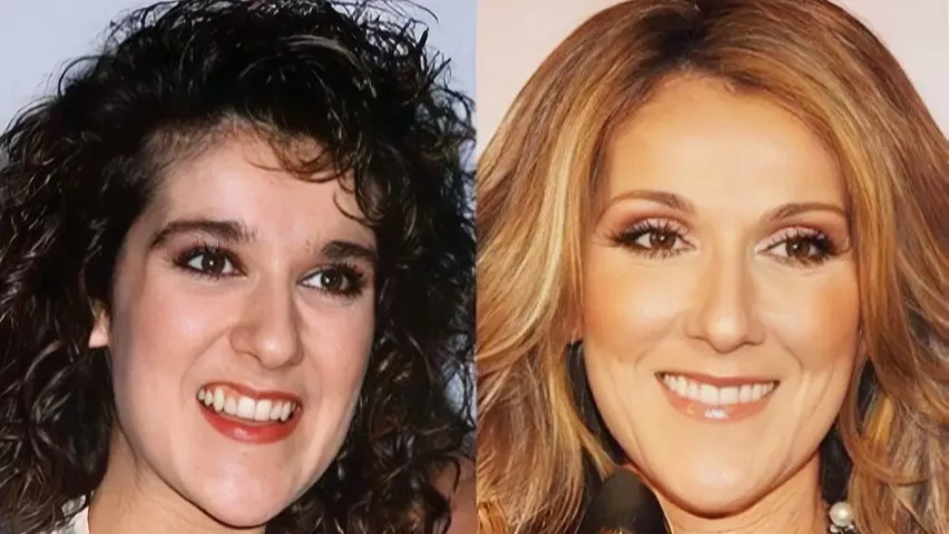 Celine Dion Before and After